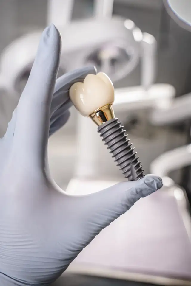 Dental implants